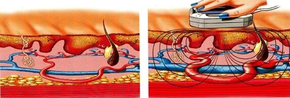 Kung ang imong mga bitiis nag-agay