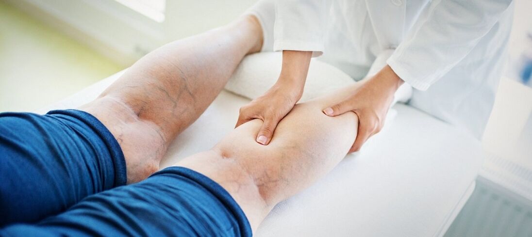 Ang mga diagnostic sa varicose veins sa ubos nga bahin