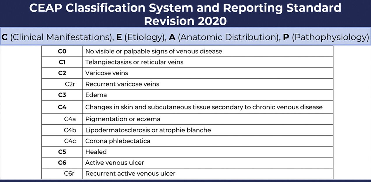 Mga hugna sa varicose veins sumala sa klasipikasyon sa CEAP nga adunay mga pag-usab gikan sa 2020